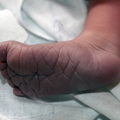 takovou mám taky nohu po hodině plavání